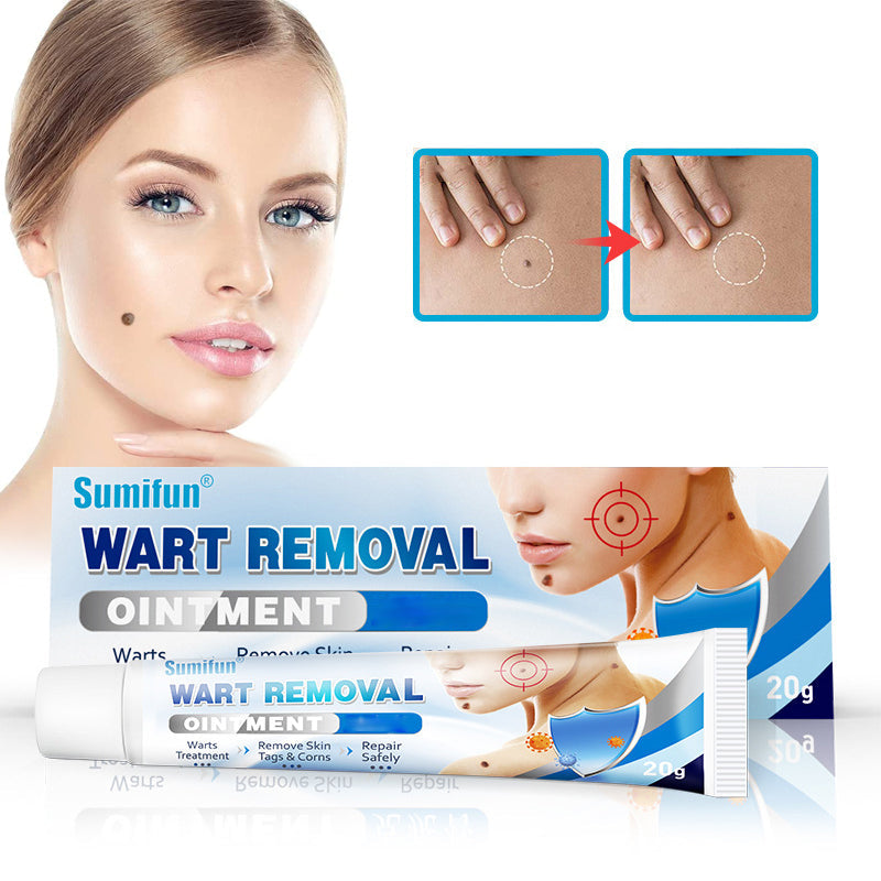 Wart Removal Ointment